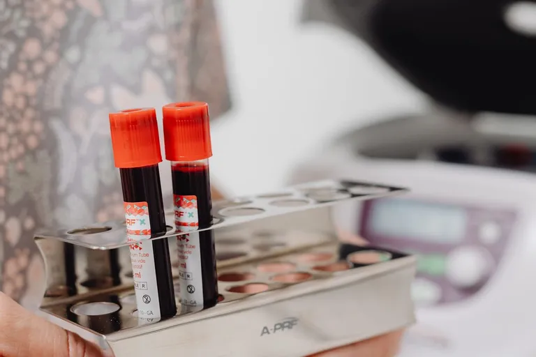 Best UK Private Blood Test Providers Compared (2026)