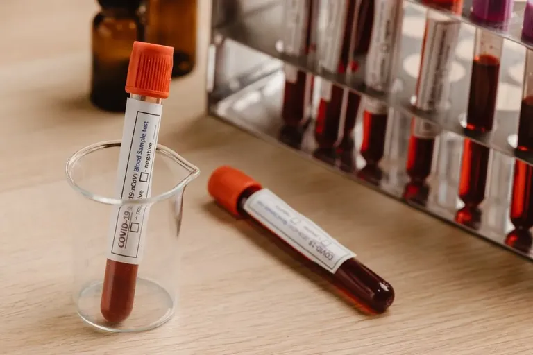CRP & Inflammation Blood Tests: UK Guide