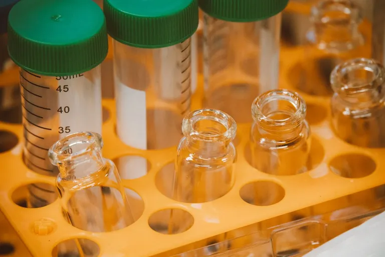 Full Blood Count (FBC) Blood Test: What It Checks and What It Costs in the UK