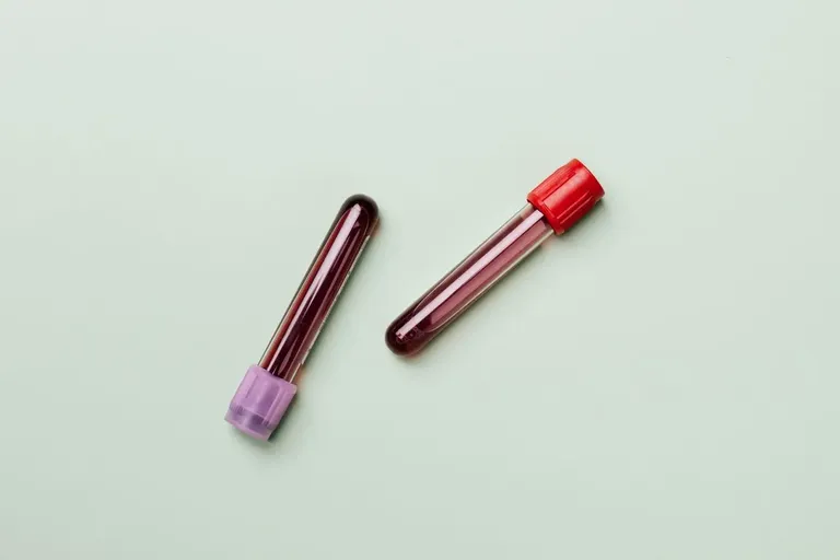 Iron Deficiency & Ferritin Blood Tests