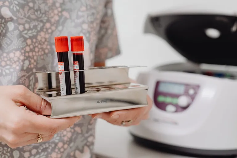 Medichecks vs Randox: Which UK Blood Test Provider Should You Choose?
