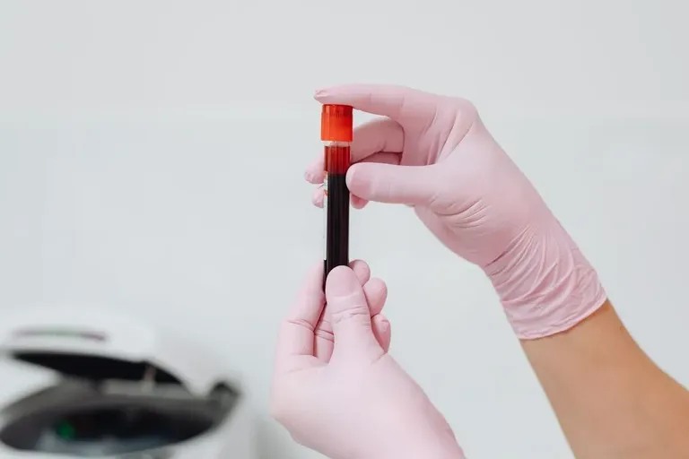 Smaller UK Blood Test Providers Compared: Monitor My Health, Vitall and Lola